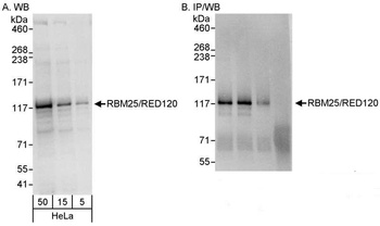Rabbit anti-RBM25/RED120 Antibody, Affinity Purified