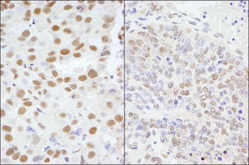 Rabbit anti-AKAP8/AKAP95 Antibody, Affinity Purified