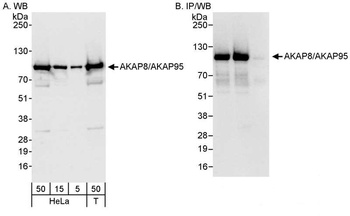 Rabbit anti-AKAP8/AKAP95 Antibody, Affinity Purified