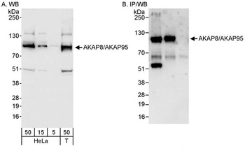 Rabbit anti-AKAP8/AKAP95 Antibody, Affinity Purified