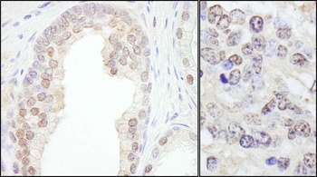 Rabbit anti-TRIM33/TIF1gamma Antibody, Affinity Purified