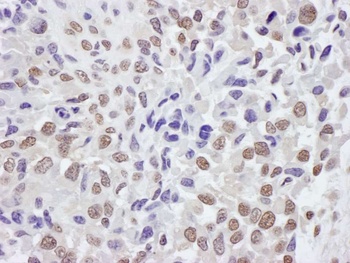 Rabbit anti-TRIM33/TIF1gamma Antibody, Affinity Purified