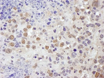 Rabbit anti-TRIM33/TIF1gamma Antibody, Affinity Purified