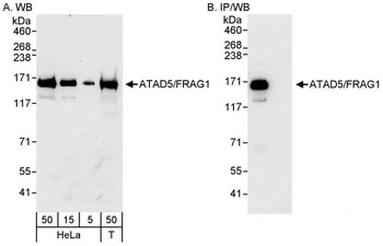 Rabbit anti-ATAD5/FRAG1 Antibody, Affinity Purified