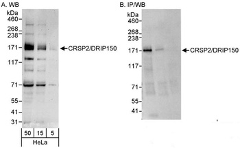 Rabbit anti-CRSP2/DRIP150 Antibody, Affinity Purified