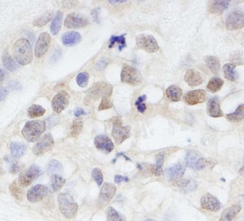 Rabbit anti-MAGED2 Antibody, Affinity Purified