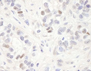 Rabbit anti-MAGED2 Antibody, Affinity Purified