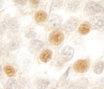 Rabbit anti-RBM10 Antibody, Affinity Purified