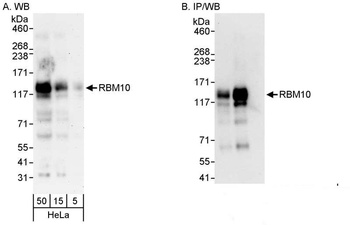 Rabbit anti-RBM10 Antibody, Affinity Purified