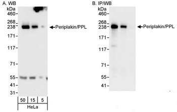 Rabbit anti-Periplakin/PPL Antibody, Affinity Purified