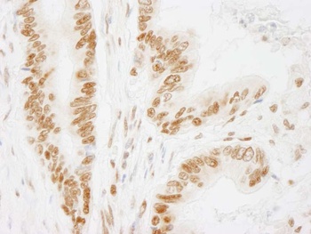 Rabbit anti-ACINUS/ACN1 Antibody, Affinity Purified
