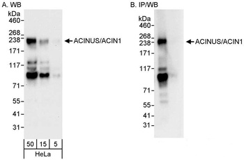 Rabbit anti-ACINUS/ACN1 Antibody, Affinity Purified