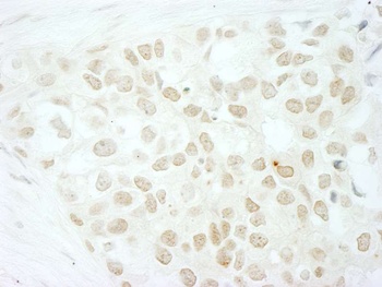 Rabbit anti-MKRN2 Antibody, Affinity Purified