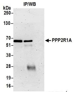 Rabbit anti-PPP2R1A Antibody, Affinity Purified