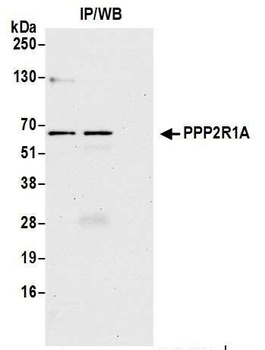 Rabbit anti-PPP2R1A Antibody, Affinity Purified