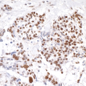 Rabbit anti-Timeless Antibody, Affinity Purified