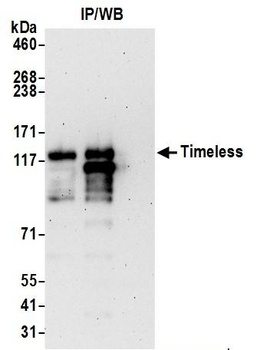 Rabbit anti-Timeless Antibody, Affinity Purified