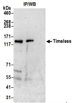 Rabbit anti-Timeless Antibody, Affinity Purified