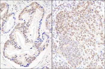 Rabbit anti-EFTUD2/SNRP116 Antibody, Affinity Purified