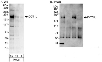 Rabbit anti-DOT1L Antibody, Affinity Purified