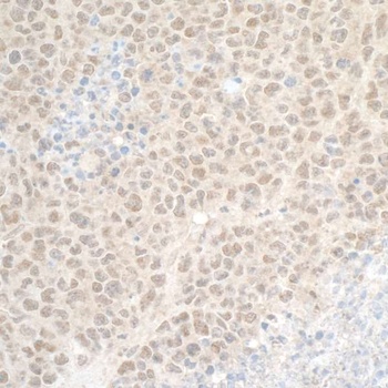 Rabbit anti-DTL/CDT2 Antibody, Affinity Purified