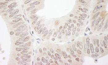 Rabbit anti-DTL/CDT2 Antibody, Affinity Purified