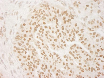 Rabbit anti-PRMT6 Antibody, Affinity Purified