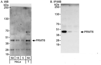 Rabbit anti-PRMT6 Antibody, Affinity Purified