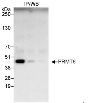 Rabbit anti-PRMT6 Antibody, Affinity Purified