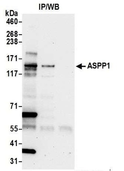 Rabbit anti-ASPP1 Antibody, Affinity Purified