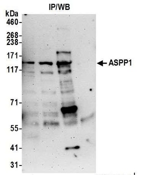 Rabbit anti-ASPP1 Antibody, Affinity Purified