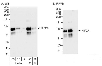 Rabbit anti-KIF2A Antibody, Affinity Purified