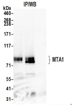Rabbit anti-MTA1 Antibody, Affinity Purified