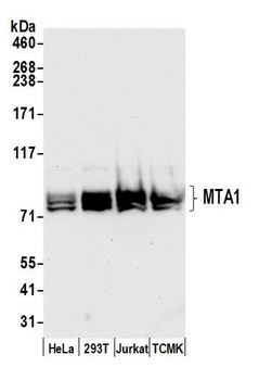 Rabbit anti-MTA1 Antibody, Affinity Purified