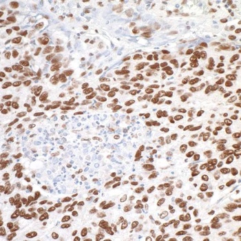 Rabbit anti-MTA1 Antibody, Affinity Purified