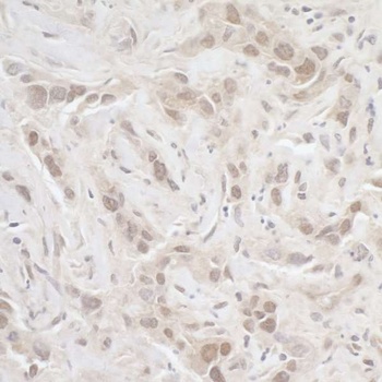 Rabbit anti-PPP3CA Antibody, Affinity Purified