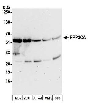 Rabbit anti-PPP3CA Antibody, Affinity Purified