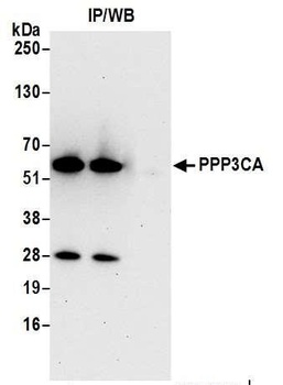 Rabbit anti-PPP3CA Antibody, Affinity Purified