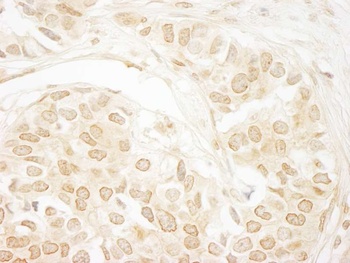 Rabbit anti-PPP3CA Antibody, Affinity Purified