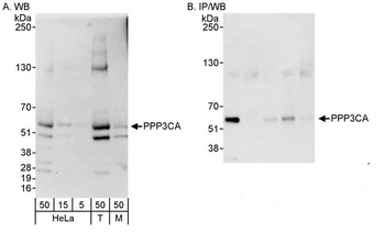 Rabbit anti-PPP3CA Antibody, Affinity Purified