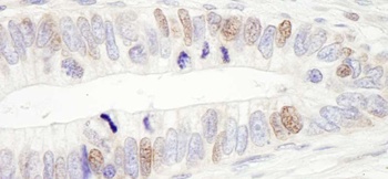 Rabbit anti-USP10 Antibody, Affinity Purified