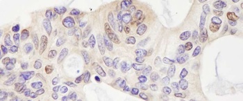 Rabbit anti-USP28 Antibody, Affinity Purified
