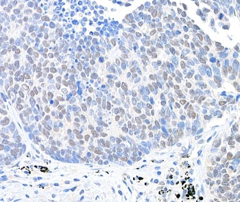 Rabbit anti-USP28 Antibody, Affinity Purified