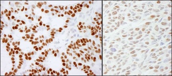 Rabbit anti-RCC2 Antibody, Affinity Purified