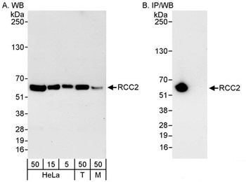 Rabbit anti-RCC2 Antibody, Affinity Purified