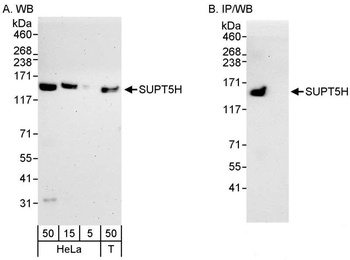 Rabbit anti-SUPT5H Antibody, Affinity Purified