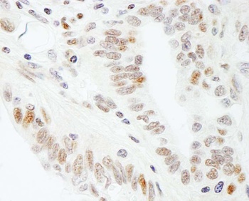 Rabbit anti-SUPT5H Antibody, Affinity Purified