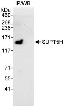 Rabbit anti-SUPT5H Antibody, Affinity Purified