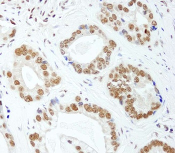 Rabbit anti-E1B-AP5 Antibody, Affinity Purified