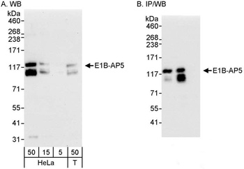 Rabbit anti-E1B-AP5 Antibody, Affinity Purified